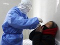 Kasus Virus Corona di Korsel Melonjak Jadi 156 Orang