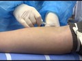 VIDEO: Donor Darah untuk Pasien Virus Corona