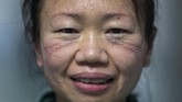 Sejauh ini belum ada obat untuk menyembuhkan virus corona. WHO menyatakan butuh waktu 12 hingga 18 bulan untuk mengembangkan vaksin corona. (Chinatopix via AP)