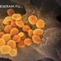 2.000 Alat Rapid Test Corona Sudah Ada di Indonesia