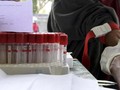 Pemda Diminta Segera Susun Protokol Uji Lab Virus Corona