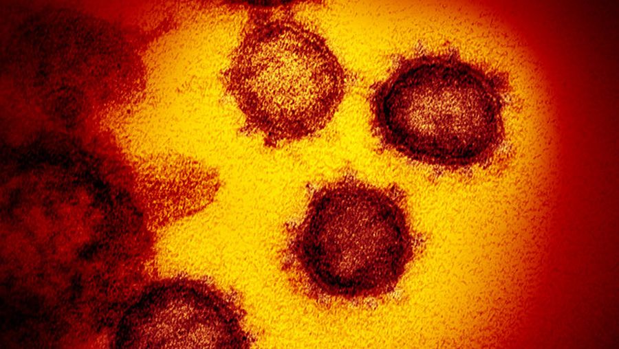 Para ilmuwan tengah mempertanyakan keakuratan dari alat rapid test kit rumahan yang kini banyak beredar di pasaran untuk memeriksa virus corona Covid-19.