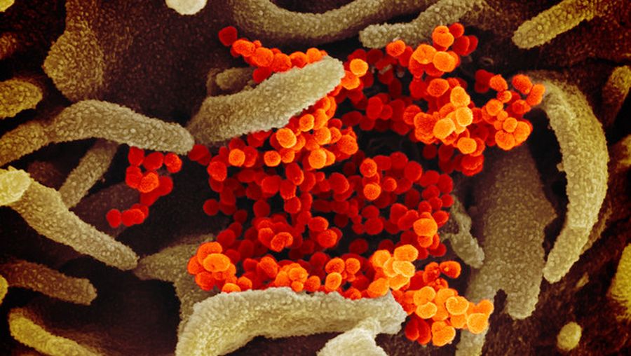 Covid-19, Virus Corona