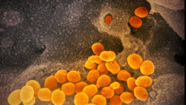 6 Aplikasi ini Bisa Tracing Persebaran Virus Corona Virus corona telah membuat menciptakan aplikasi pelacakan (tracing) terhadap masyarakat di suatu negara.