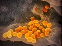 Mei Sudah Kemarau di RI, Penyebaran Virus Corona Bakal Turun?