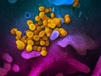 Berapa Lama Virus Corona Covid-19 Bertahan Hidup?