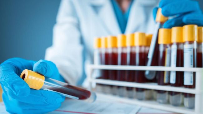 DKI Rapid Test Corona Perdana, Ambil 520 Sampel di Jaksel