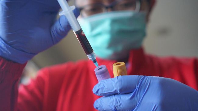 Obati Corona, RSCM-FKUI Cari Donor Plasma Darah Penyintas - CNN Indonesia