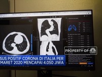 Alasan Italia Tak Buru-Buru Cabut Lockdown