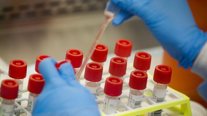 FILE - In this Wednesday, March 11, 2020 file photo, a technician prepares COVID-19 coronavirus patient samples for testing at a laboratory in New York's Long Island. Wide scale testing is a critical part of tracking and containing infectious diseases. But the U.S. effort has been plagued by a series of missteps, including accuracy problems with the test kits the CDC sent to other labs and bureaucratic hurdles that slowed the entrance of large, private sector labs. (AP Photo/John Minchillo)