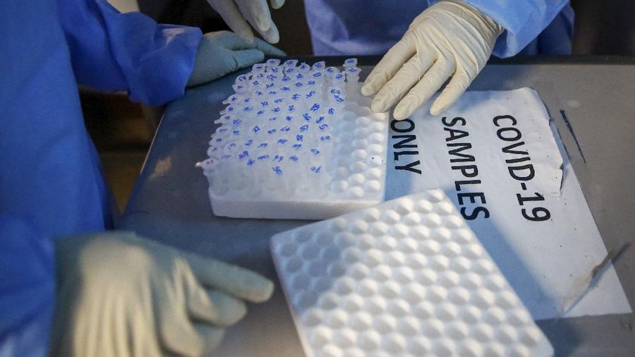 In this photo taken Sunday, April 5, 2020, laboratory technicians handle microcentrifuge tubes containing patient samples to be tested for the new coronavirus that causes COVID-19, at the Pathologists Lancet Kenya laboratory in Nairobi, Kenya. The company, which is offering tests to patients with a doctor's referral, was previously having to send samples to South Africa for testing but is now completing the testing in-house in Kenya. (AP Photo/Brian Inganga)