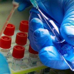 Ratusan Vaksin & Obat Covid-19 Dikembangkan, Ini Daftarnya
