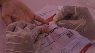 BPPT Kembangkan PCR Kit dengan Varian Gen Corona di Indonesia