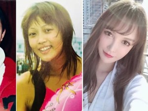 Wanita China Kecanduan Operasi Plastik, Sudah 100 Kali Oplas Sejak Umur 14