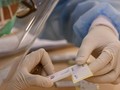 Peneliti Kembangkan Tes Antibodi Baru Deteksi Covid-19