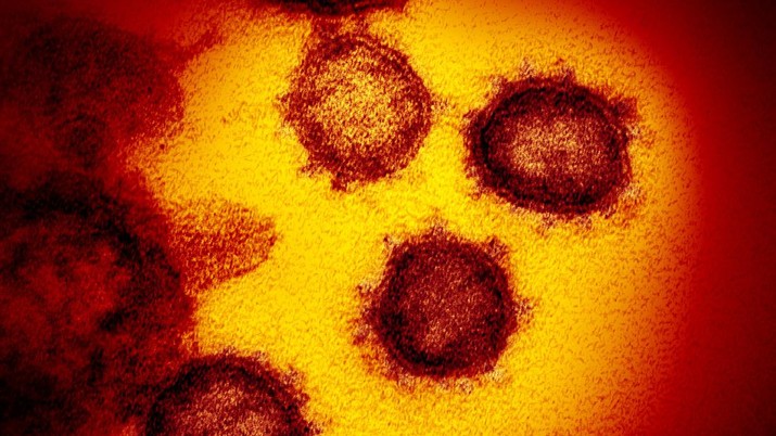 FILE - This undated electron microscope image made available by the U.S. National Institutes of Health in February 2020 shows the virus that causes COVID-19. (NIAID-RML via AP, File)