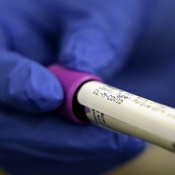 Gokil, Vaksinnya Dipesan 4 Negara, Saham AstraZeneca Cuan 31%