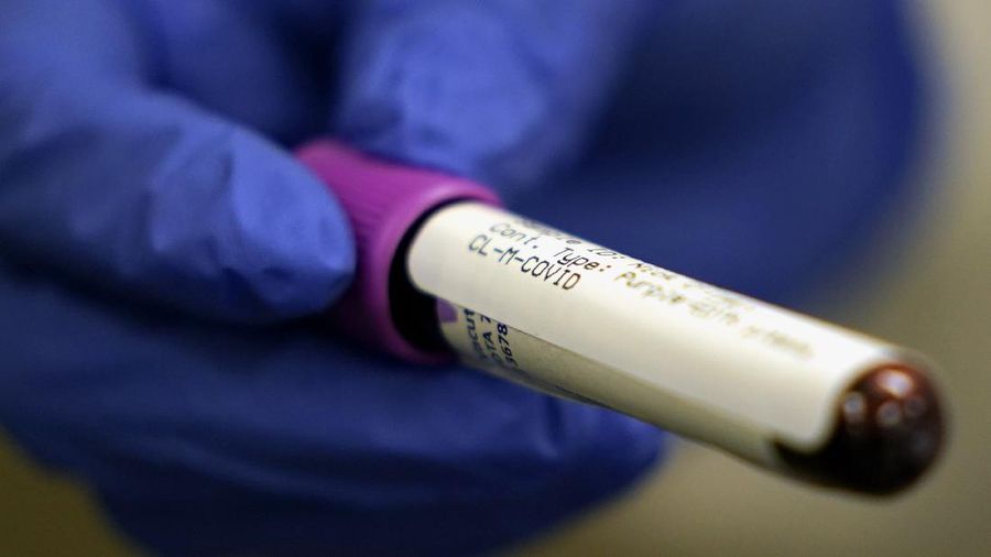 A lab assistant holds a blood sample to be tested for COVID-19 antibodies, Tuesday, April 28, 2020, at Principle Health Systems and SynerGene Laboratory, in Houston. The company, which opened two new testing locations Tuesday, is now offering a new COVID-19 antibody test developed by Abbott Laboratories. (AP Photo/David J. Phillip)