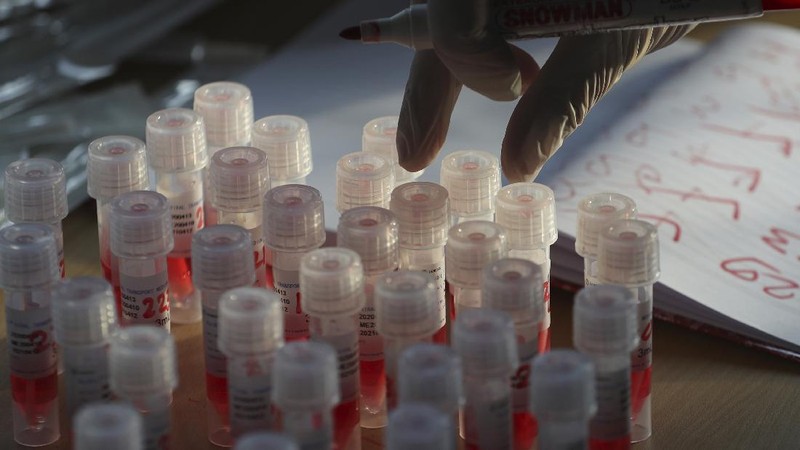 People line up to wait to receive a swab test for the new coronavirus at a train station in Bekasi on the outskirts of Jakarta, Indonesia, Tuesday, May 5, 2020. (AP Photo/Achmad Ibrahim)