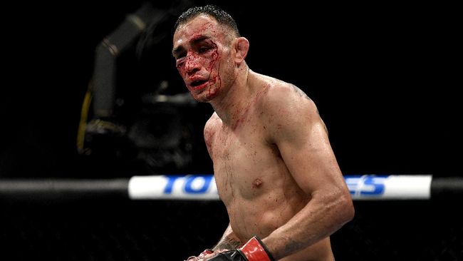 Wajah Hancur Dihajar Gaethje, Ferguson Dibawa ke Rumah Sakit