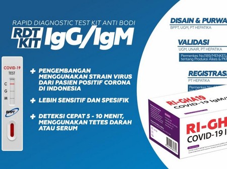 Masih Bingung Baca Hasil Tes Covid 19 Begini Lho Caranya Masih Bingung Baca Hasil Tes Covid 19 Begini Lho Caranya