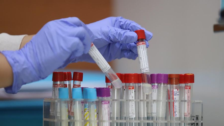 Pemeriksaan SARS-CoV-2 RNA dengan metode real-time RT-PCR (PCR COVID-19) yang mendeteksi 3 (tiga) target gen sekaligus yaitu Gen E, N, dan RdRP sesuai dengan protokol yang ditetapkan World Health Organization (WHO). (CNBC Indonesia/Muhammad Sabki)