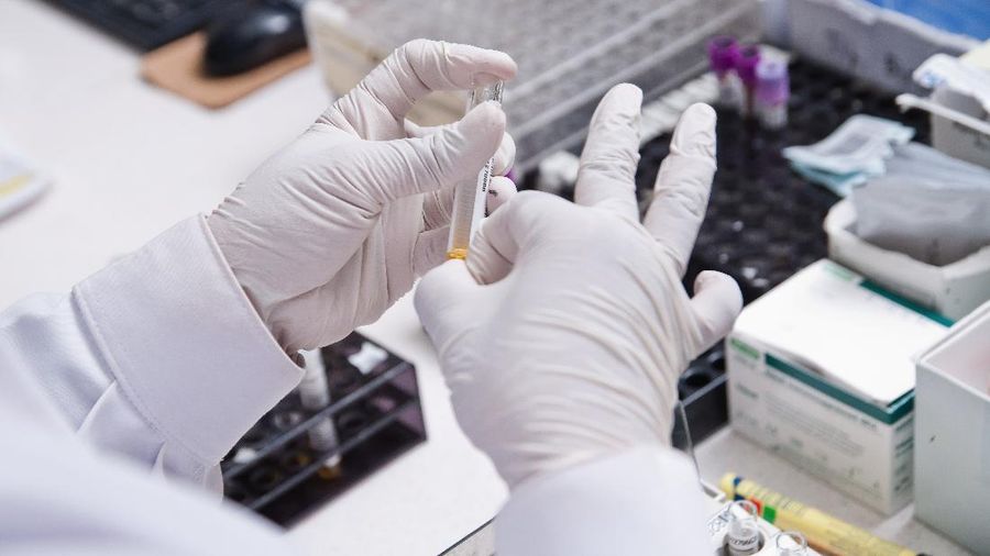 Pemeriksaan SARS-CoV-2 RNA dengan metode real-time RT-PCR (PCR COVID-19) yang mendeteksi 3 (tiga) target gen sekaligus yaitu Gen E, N, dan RdRP sesuai dengan protokol yang ditetapkan World Health Organization (WHO). (CNBC Indonesia/Muhammad Sabki)