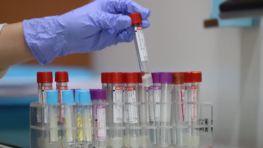 Pemeriksaan SARS-CoV-2 RNA dengan metode real-time RT-PCR (PCR COVID-19) yang mendeteksi 3 (tiga) target gen sekaligus yaitu Gen E, N, dan RdRP sesuai dengan protokol yang ditetapkan World Health Organization (WHO). (CNBC Indonesia/Muhammad Sabki)