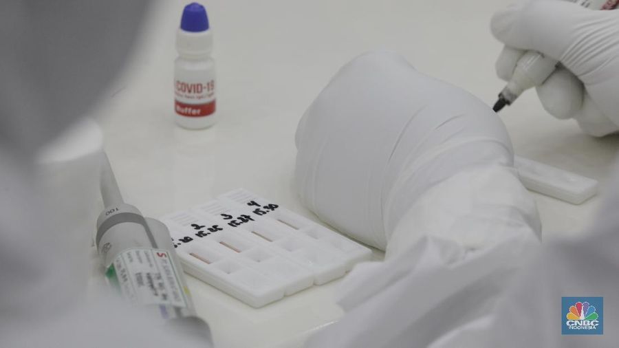 Alat rapid diagnostic test Corona RI-GHA COVID-19 (CNBC Indonesia/ Tri Susilo)
