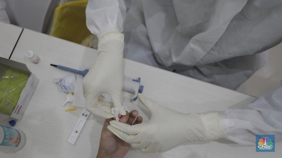 Alat rapid diagnostic test Corona RI-GHA COVID-19 (CNBC Indonesia/ Tri Susilo)