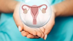 Kebanyakan Makan Seblak Bisa Picu Kista Ovarium? Tenang Dulu, Begini Kata Obgyn