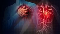 The Significance of Heart Disease Screening: Avoiding Complications