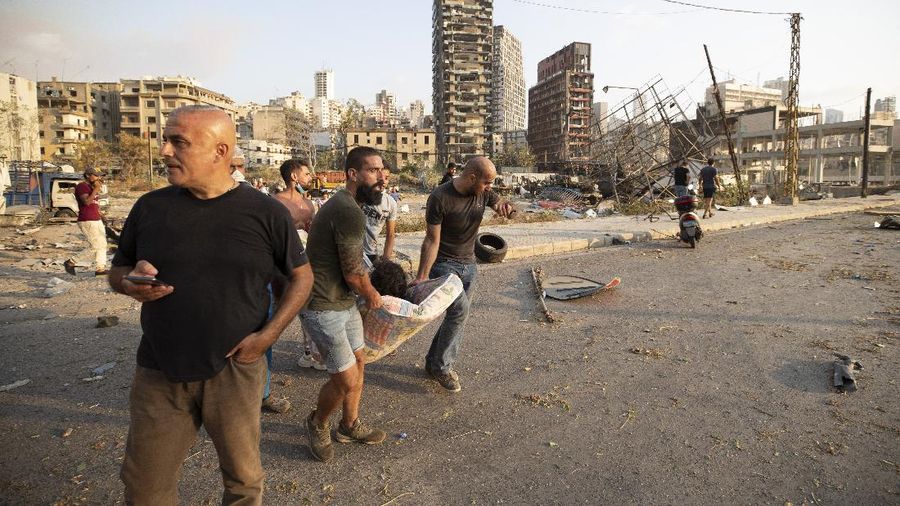 People carry a wounded after a massive explosion in Beirut, Lebanon, Tuesday, Aug. 4, 2020. Massive explosions rocked downtown Beirut on Tuesday, flattening much of the port, damaging buildings and blowing out windows and doors as a giant mushroom cloud rose above the capital. Witnesses saw many people injured by flying glass and debris. (AP Photo/Hassan Ammar)