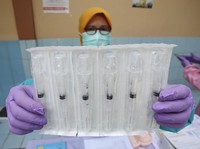 Pemerintah Siapkan Vaksin Campak Dewasa, Segini Dosisnya
