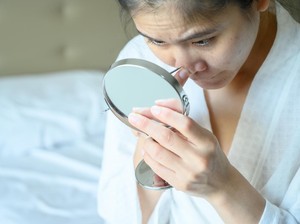 Lagi Ngetren Acne Patch Warna-warni, Dokter Kulit Beri Catatan saat Dipakai