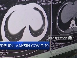 WHO: Tidak Semua Orang Akan Punya  Akses Ke Vaksin Covid-19