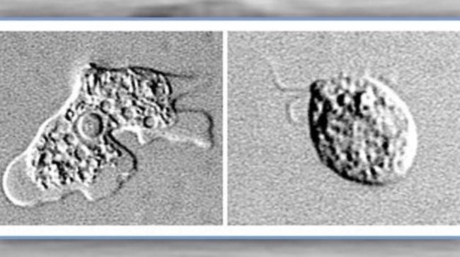 Waspada Ada Amuba  Pemakan Otak