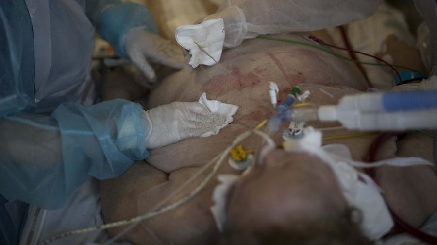 Gelombang kedua virus corona di Prancis menjadi mimpi buruk bagi tim medis. Lonjakan kasus baru Covid-19 di Prancis terus terjadi sejak September lalu. (AP/Daniel Cole)