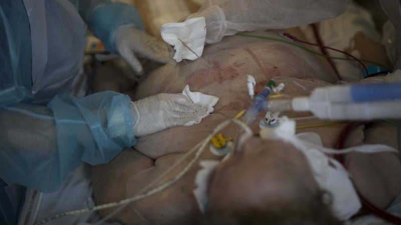 Gelombang kedua virus corona di Prancis menjadi mimpi buruk bagi tim medis. Lonjakan kasus baru Covid-19 di Prancis terus terjadi sejak September lalu. (AP/Daniel Cole)