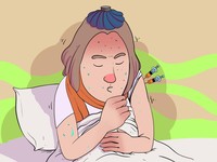 Fakta Lupus, Penyakit Autoimun Kronis yang Belum Ada Obatnya