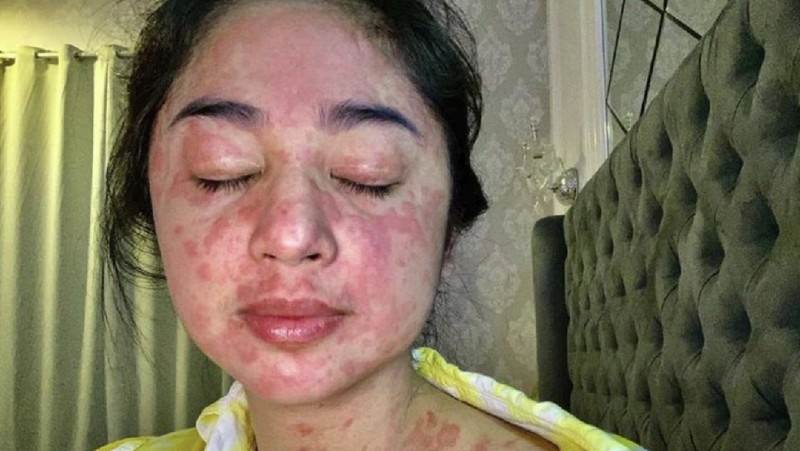 dewi perssik (Ist Detik Hot)