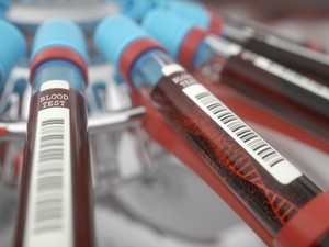 Wanita Ini Iseng Lakukan Tes DNA ke Pasangan, Hasilnya Bikin Kaget