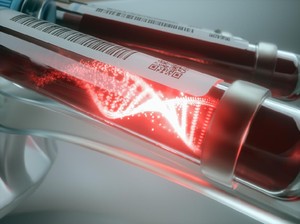 Risiko Ebola Meningkat, Kanada dan Bahama Terapkan Pembatasan untuk 3 Negara Afrika