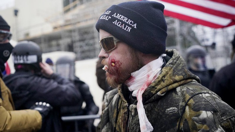 A Trump supporter is detained by LAPD officers after a brawl with counter protesters  in Los Angeles on Wednesday, Jan. 6, 2021. (Sarah Reingewirtz/The Orange County Register via AP)