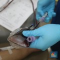 WHO Tak Anjurkan Plasma Darah Konvalesen Buat Obati Covid-19