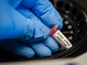 Virus Nipah Mematikan Muncul di India, Kemenkes Wanti-wanti Gejala dan Sumber Penularan