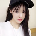 Sosok Artis Cantik Gao Liu yang Hidungnya Busuk Pascaoperasi