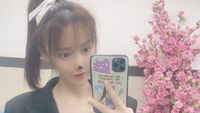 Sosok Artis Cantik Gao Liu yang Hidungnya Busuk Pascaoperasi