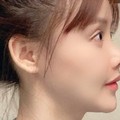 Ya Ampun Kesian! Hidung Artis China Ini Membusuk Usai Operasi