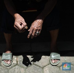 Oh No! Kena Covid-19, Pria Ini Ereksi Panjang 3 Jam